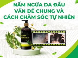 NẤM NGỨA DA ĐẦU VÀ CÁCH CHĂM SÓC TỰ NHIÊN